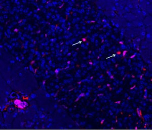 L'immagine al microscopio mostra la morte delle cellule che secernono insulina (rosso) in un topo diabetico. Una morte a cascata delle cellule è stata data da un processo che si verifica quando le molecole dannose fuoriescono da una parte della cella in altre aree a cui non appartengono. Credit: Uran laboratory-Washington University