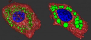 Le cellule di grasso con la mutazione del ankyrin-B R1788W (mostrato a destra) hanno ampliato le gocce lipidiche. Il colore verde mette in evidenza i siti di stoccaggio dei grassi nelle cellule adipose del topo. I nuclei sono mostrati in blu.