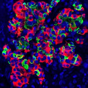 Non solo il pancreas: anche il cervello produce insulina