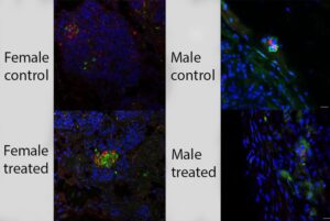 Il cocktail che potrebbe rivoluzionare il trapianto di isole pancreatiche